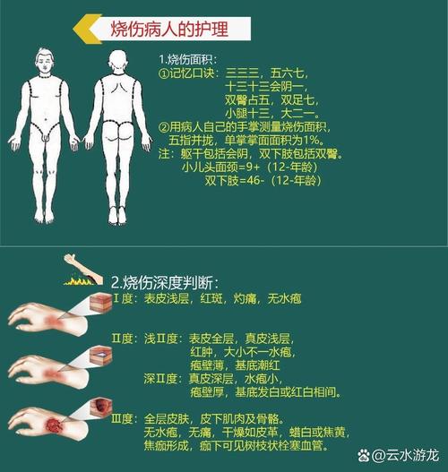 磨削烧伤到底怎么来的?
