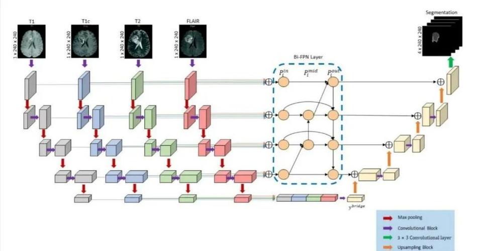 轻量型肺结节医学影像分割模型推理流程示意图