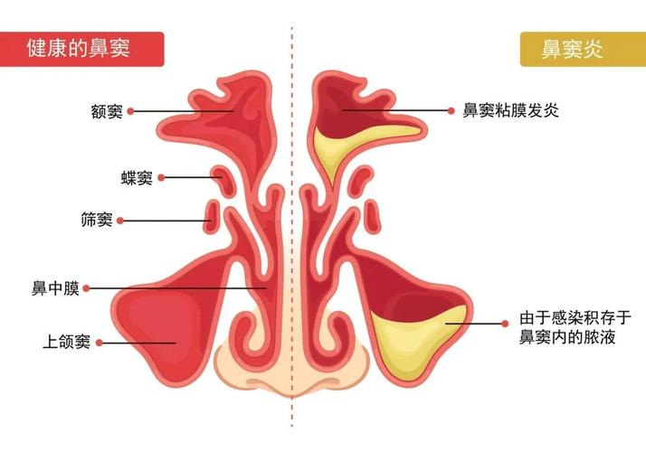 婴幼儿鼻腔生理结构对比图